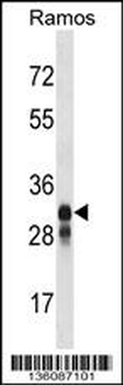 HLA-DMB Antibody (Center)