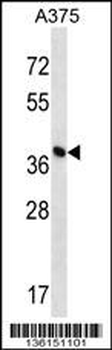 DPH1 Antibody (C-term)