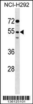 SIRPG Antibody (Center)