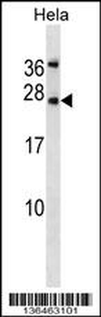 LEP Antibody (N-term)