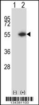 DTNBP1 Antibody (N-term)