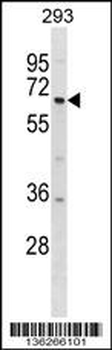 DYRK1B Antibody (Center)