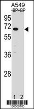 ASB3 Antibody (N-term)