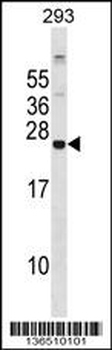 GPX8 Antibody (C-term)