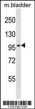 TOP3B Antibody (C-term)