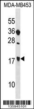 SIT1 Antibody (C-term)