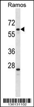PLRG1 Antibody (N-term)