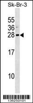 ARL1 Antibody (Center)