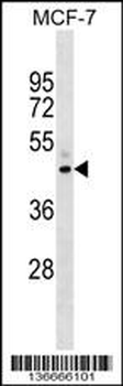 NR2F6 Antibody (N-term)