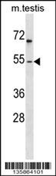 FOXF1 Antibody (N-term)