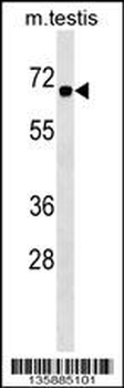 CBX2 Antibody (Center)