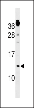CKS1B Antibody (Center)