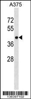 METAP1 Antibody (Center)