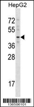 TBX20 Antibody (C-term)