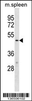 TBX20 Antibody (C-term)