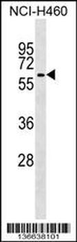 TRIM68 Antibody (C-term)