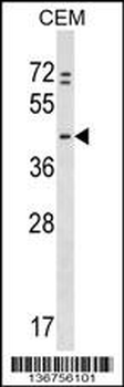 PRKAR1B Antibody (N-term)