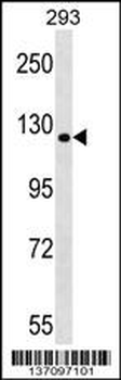 TBC1D1 Antibody (Center)