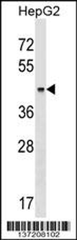 KRT23 Antibody (Center)