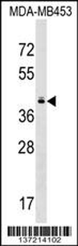 TAS2R10 Antibody (Center)