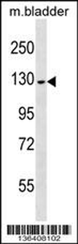 PRDM10 Antibody (Center)