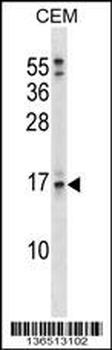 SOSTDC1 Antibody (C-term)
