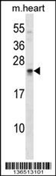 SOSTDC1 Antibody (C-term)