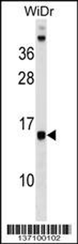 DAD1 Antibody (C-term)