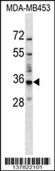 BATF2 Antibody (N-term)