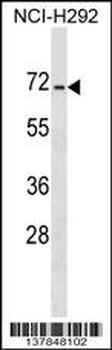 DACT3 Antibody (N-term)