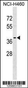 TPM2 Antibody (C-term)