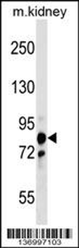 PNPT1 Antibody (Center)