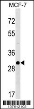 RAB26 Antibody (C-term)