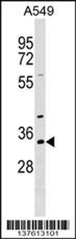 RBM11 Antibody (N-term)
