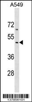 EMID2 Antibody (Center)