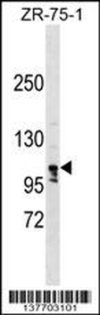 LARP1B Antibody (C-term)