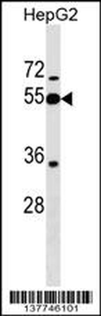 PI16 Antibody (Center)