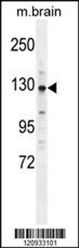 CYLN2 Antibody (C-term)