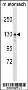 SRGAP1 Antibody (Center)
