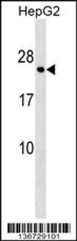 HLA-DPA1 Antibody (C-term)