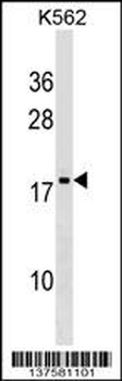 DR1 Antibody (Center)