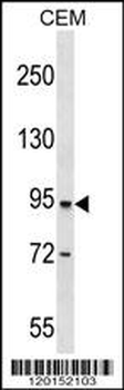 DPP4 Antibody (Center)