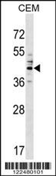 CEACAM6 Antibody (Center)