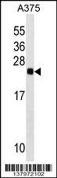 RAB2B Antibody (Center)