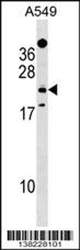 EFHD1 Antibody (Center)