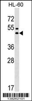 GPR20 Antibody (C-term)