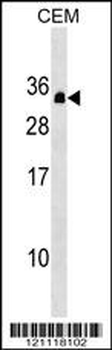 PDCD10 Antibody (Center)