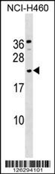 GLIPR1L1 Antibody (C-term)