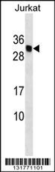 HLA-DMB Antibody (Center)