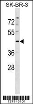 Mouse Stk24 Antibody (Center)